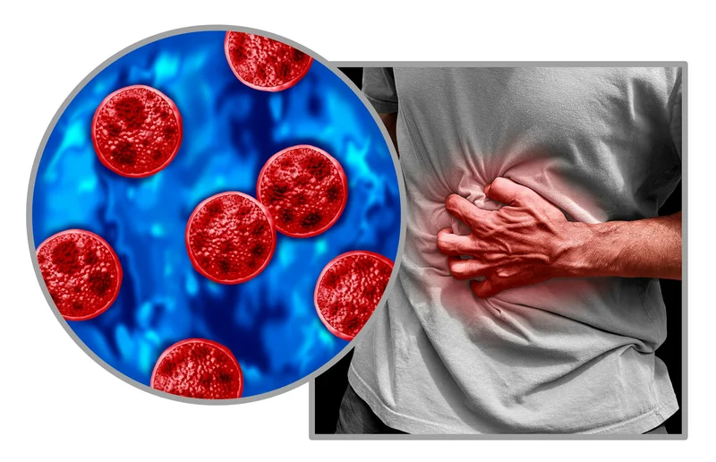 Cyclosporiasis sickens some people worse – why your diarrhea could be more explosive than others