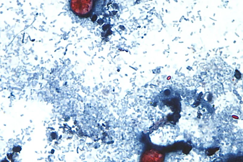 Taylor Farms recalls lettuce shipped to 27 states over cyclospora risk