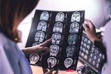 5 Recent Dementia Research Advances &mdash; From Blood Tests and Lithium to Lifestyle Changes