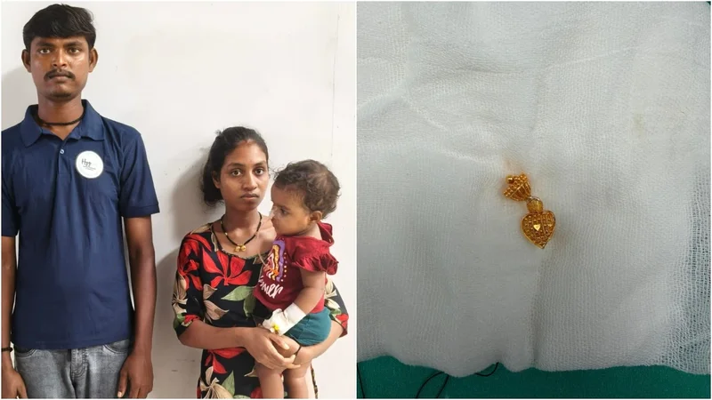 Surat infant survives after doctors remove earring she swallowed in 45 minutes