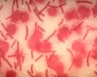 AI can fuel biological weapons. We must harness its power for defense | Annie Jacobsen