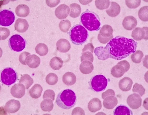 Rare BTK mutation drives resistance to targeted therapies for blood cancer