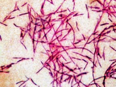 6th person dies from Legionnaires' disease in New York City: Health officials