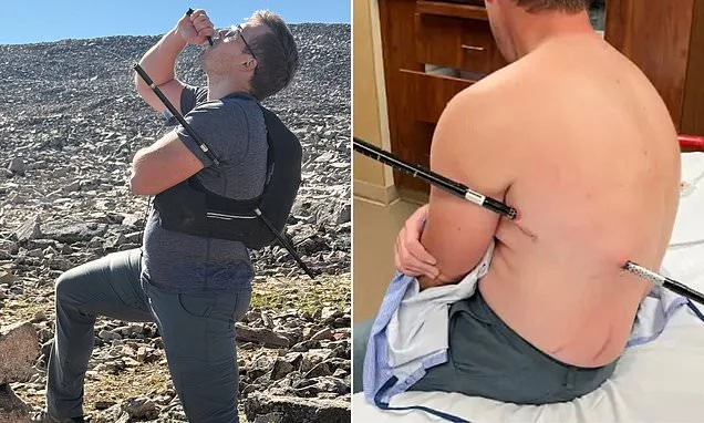 Hiker IMPALES himself in freak accident on side of a mountain - then walked 10 more miles to avoid getting ambulance bill