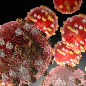 Palmerston North measles case prompts investigation into possible spread