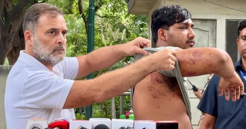 Rush Hour: Rahul Gandhi says pellet guns fired at students, HC refuses NIA probe into protest & more