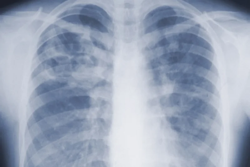 ‘Kind of the first time we’ve had an estimate like this’: first CDC study on mold finds it’s much deadlier than we thought