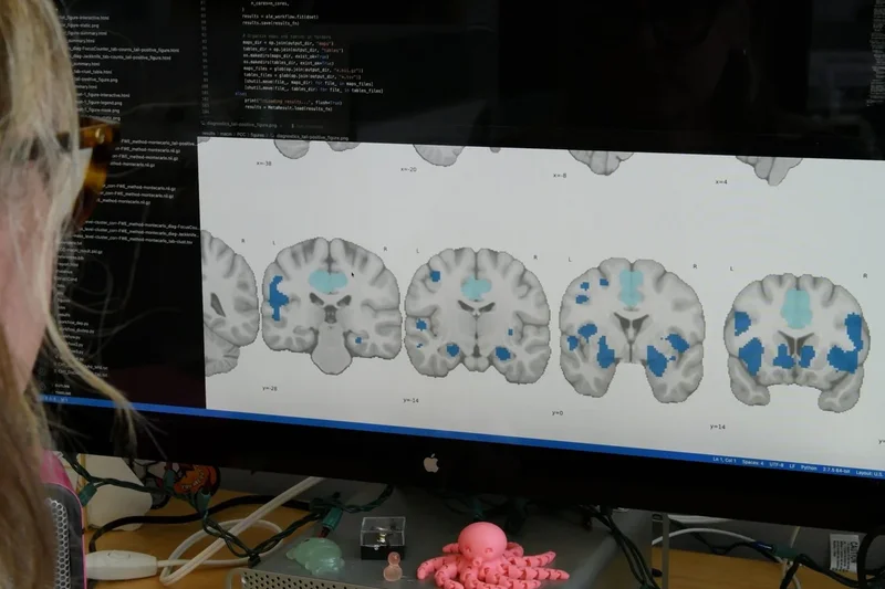 Poor sleep is doing more than making you tired – it’s changing the way your brain works