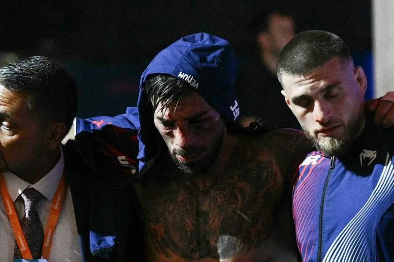 Ilia Topuria shares facial injury update after hiding UFC wounds for six weeks