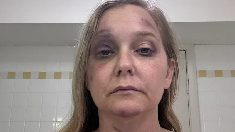 Battered, bruised, then banned from seeing her kids. How did Virginia Giuffre get here?