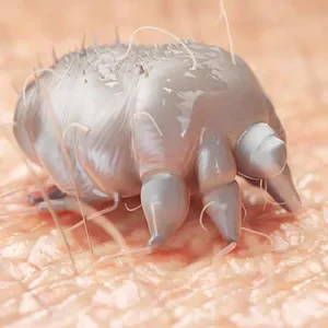 Scabies cases surge across North Island as school, health clinic issue warnings