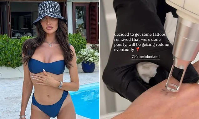 Kate Cassidy gets her Liam Payne 'angel' tattoo tribute removed from her hand 21-months after the One Direction star tragically died