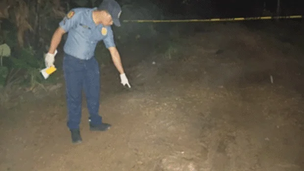 Bukidnon woman survives gunshot to the face