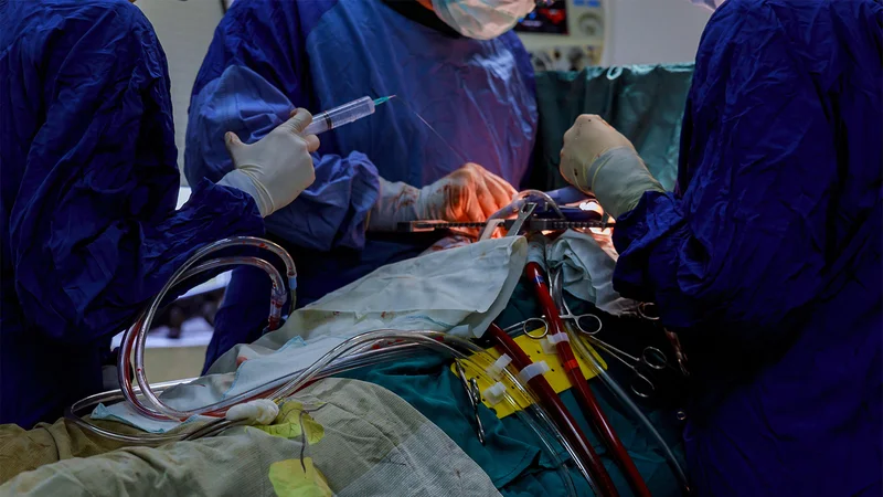 Dapagliflozin Makes Good on Preventing Cardiac Surgery-Associated AKI