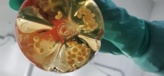 The Remarkable Lives of 5-Year-Old Brain Organoids
