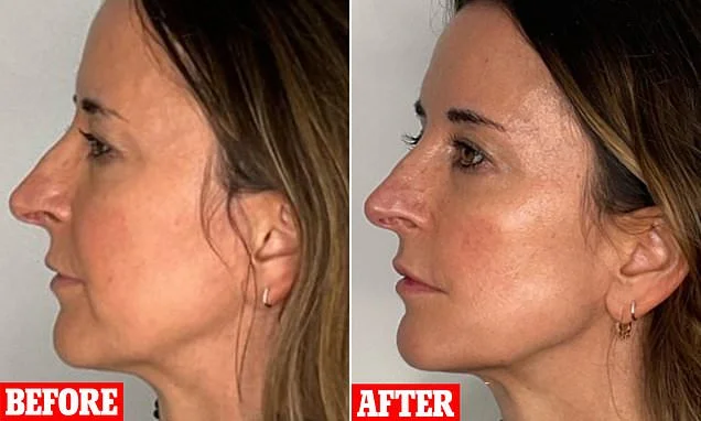 The one-hour facelift that left me looking years younger: I've tried all the tweakments but I was staggered by this method that made my jawline so much more defined and gave me back the fresh, vibrant face I thought I had lost