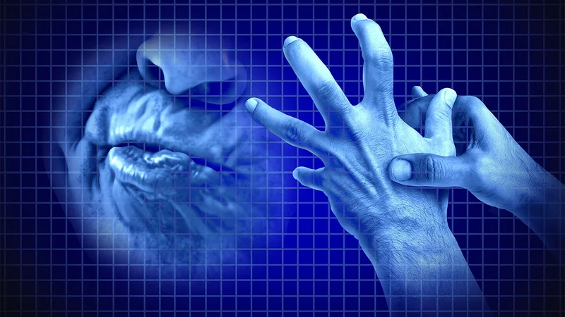 Tardive Dyskinesia a 'Silent Driver' of Healthcare Spending