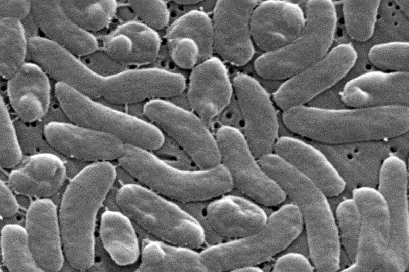 A ‘flesh-eating bacteria’ is spreading worldwide. Here’s how to protect yourself