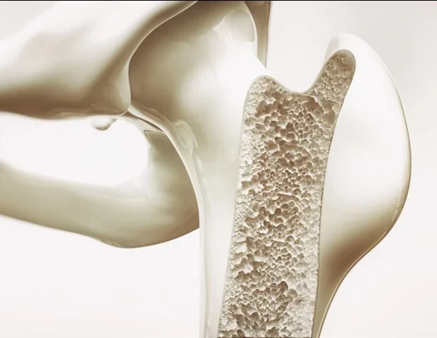 New study reveals genetic drivers of inherited bone marrow failure syndrome