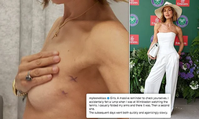 Myleene Klass, 48, reveals cancer scare after finding two lumps in her breast as she describes the experience as 'sobering, humbling and terrifying'