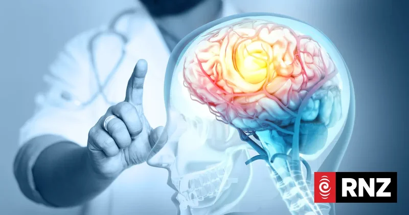 Trained neurologists quitting NZ due to lack of jobs and funding, experts say