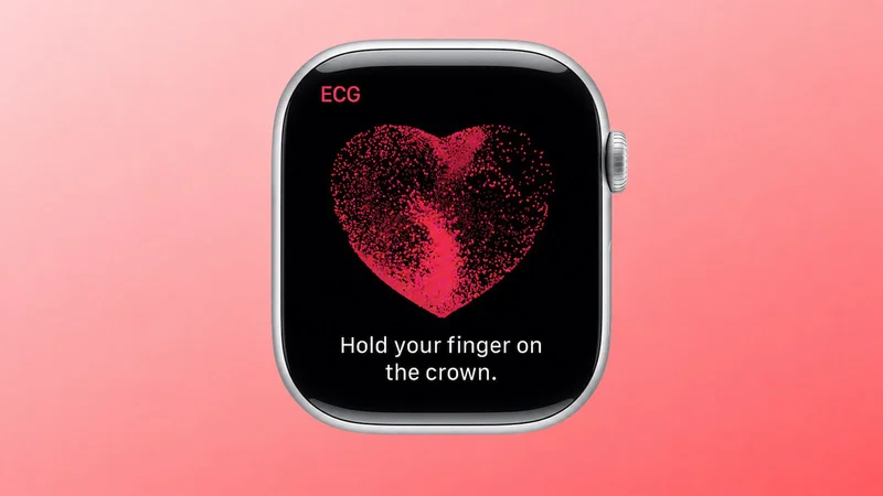 Apple Watch Alerted Runner to Serious Heart Problem