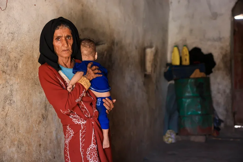 Fallout from war in Iran is leaving millions vulnerable to hunger