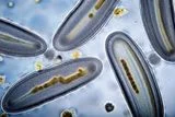 Overlooked Foodborne Parasites Caused an Estimated 171 Million Illnesses Worldwide in a Single Year