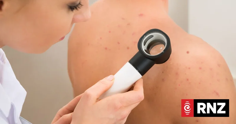 'The type of treatment we're looking for': Worldwide cancer trial shows promise in treatment of melanoma