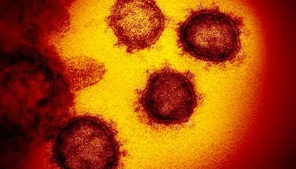 Covid-19 Can Reawaken Dormant Viruses in the Body, Which Might Worsen Symptoms of the Respiratory Illness, Study Suggests