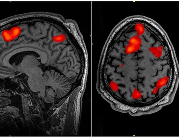 Light-field microscopy enables snapshot volumetric imaging of fast neural activit