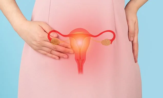 Doctors discover intriguing op can cut risk of 'hidden killer' ovarian cancer risk by 80%