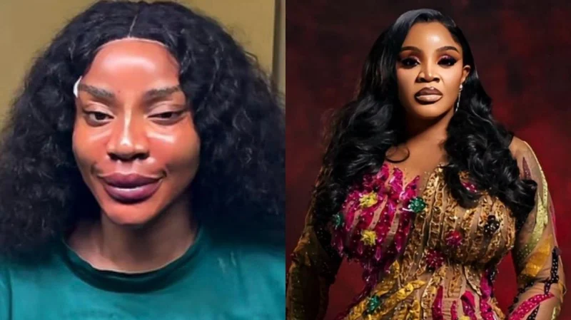 ‘I got me a new face’ – Uche Ogbodo announces threads, fillers, PDO treatments