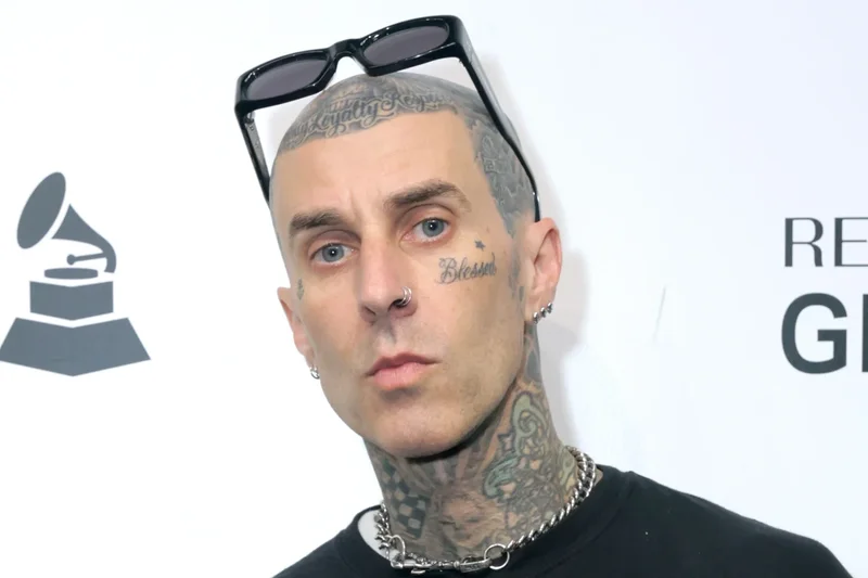 Travis Barker shares harrowing new details about plane crash: ‘65% of my body was burned’