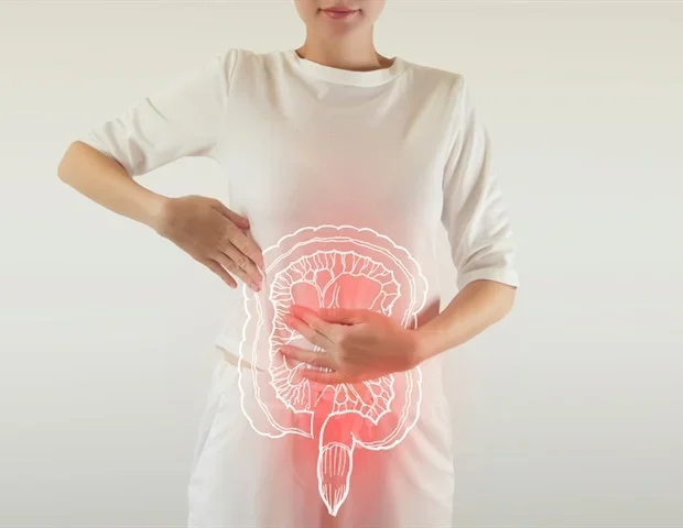 Inflammatory bowel disease linked to elevated risk of psychiatric disorders