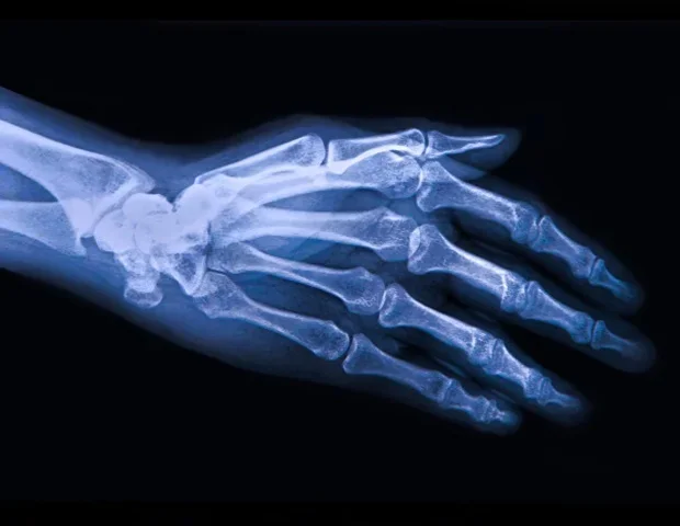 New review explores purinergic signaling pathways in osteoarthritis progression