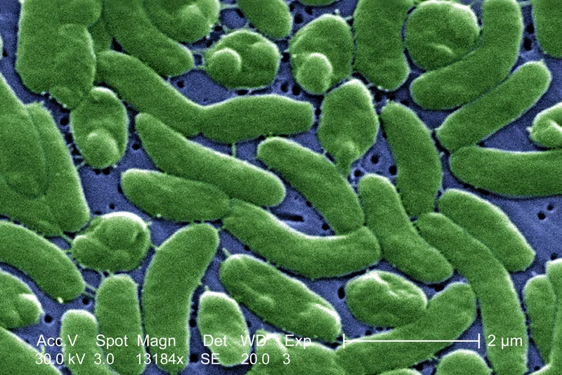 Flesh-eating bacteria are devouring limbs in warming waters worldwide − here’s how to protect yourself