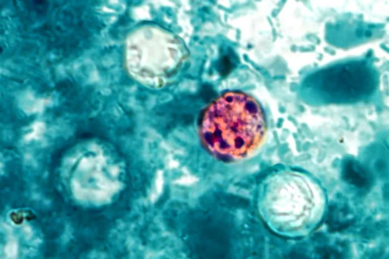 Michigan reports two deaths in cyclosporiasis outbreak