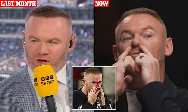 Wayne Rooney reveals he's had plastic surgery to fix his nose after breaking it twice during his football career - and is now left with two tubes up his nostrils