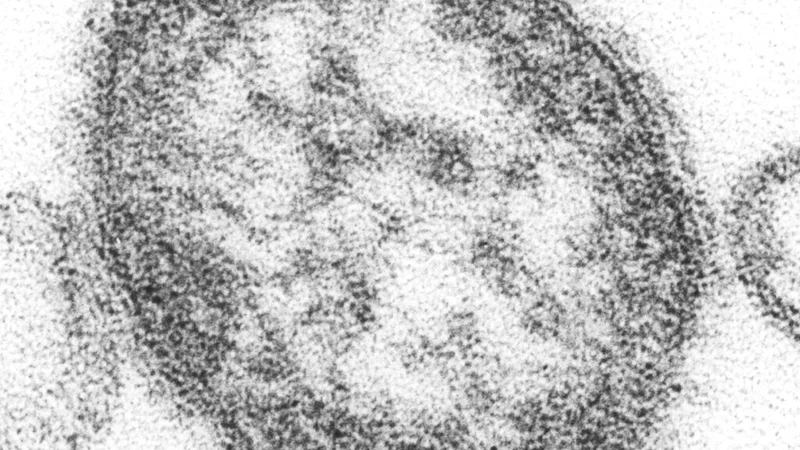 Opinion: What my colleagues and I will look for as we assess U.S. measles elimination status