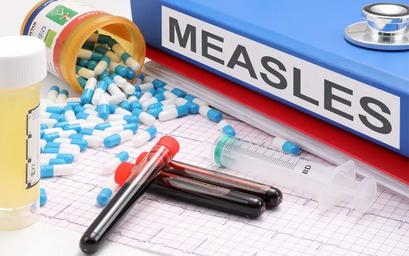 US records highest measles infections in 35 years