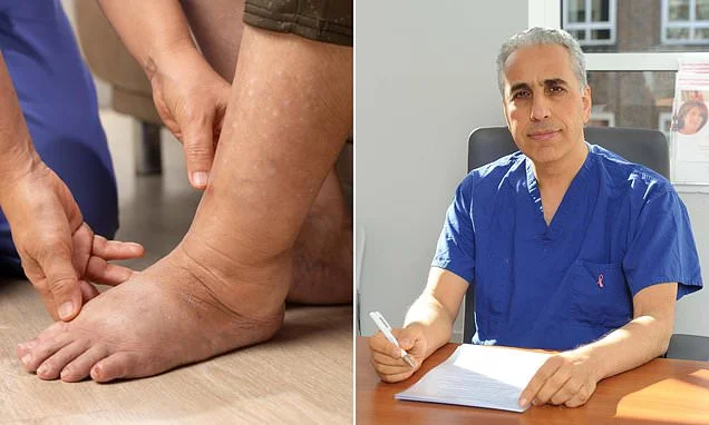 The cheap, everyday item that could REVERSE lymphoedema: Thousands suffer from the condition that has no cure. Now, top researchers reveal their groundbreaking discovery that could finally offer hope