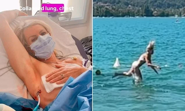 BBC ski presenter Chemmy Alcott suffers a collapsed lung and is left struggling to breathe as she is rushed to hospital after a 'badly timed front flip' while jumping into Lake Annecy
