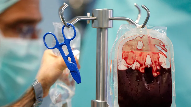 Can Brain Proteins Spread by Blood Transfusions? Early Research Prompts Closer Look.