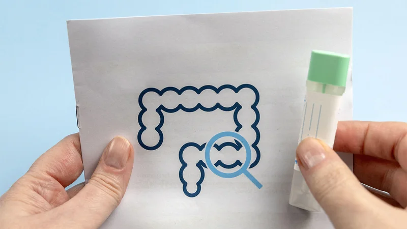 FIT-Based Screening Linked to Drop in Colorectal Cancer Mortality