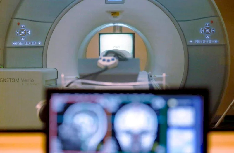 Clinics, technicians unsure of Alberta’s new self-referral method for health tests
