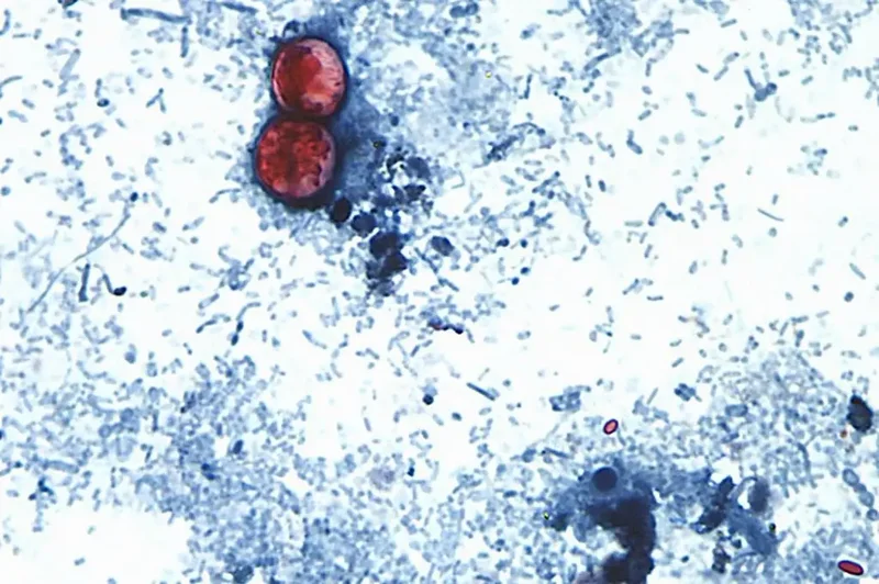 Michigan reports first U.S. deaths from multi-state cyclosporiasis outbreak