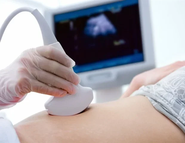New AI spots hypertrophic cardiomyopathy obstruction from standard ultrasounds