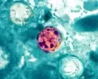 Two people have died amid US cyclosporiasis outbreak, Michigan officials say