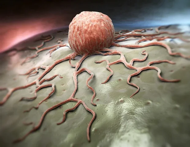 Genetic tool turns soft cancer cells into immune targets